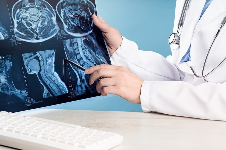 Female Doctors Hand Pointing At X-ray