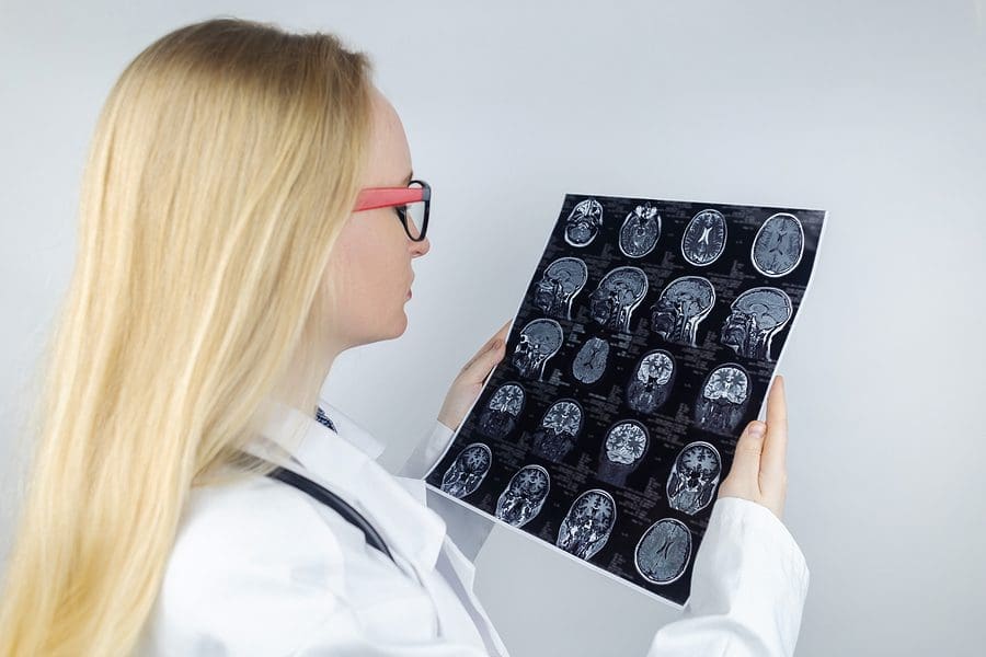 MRI of the brain. Neuropathologist holds a picture against the background of a light device to check for coup vs. contrecoup brain injuries