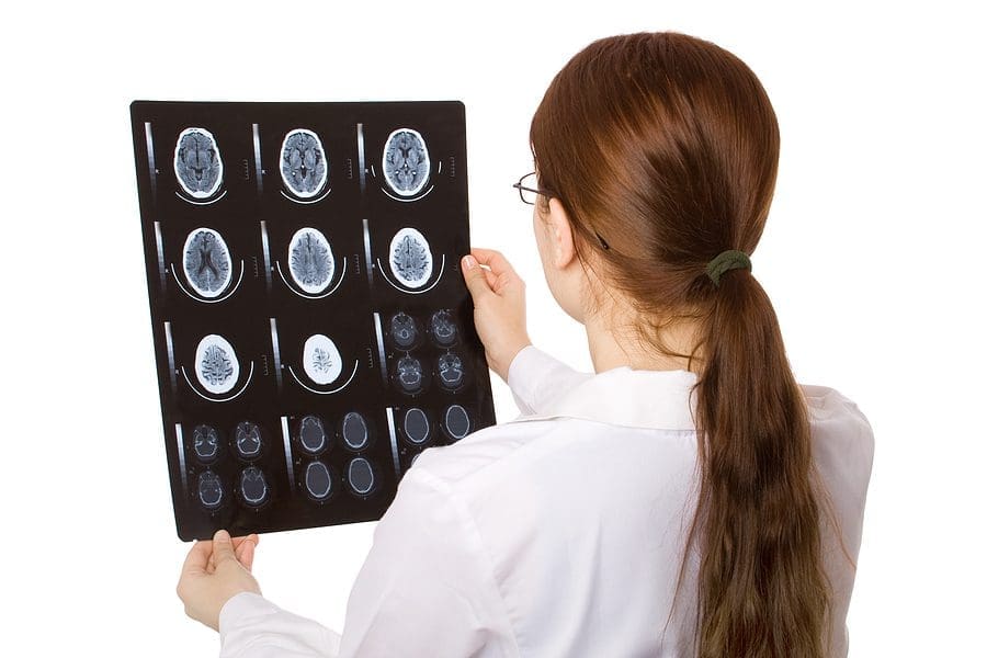 Doctor reviewing X-Ray